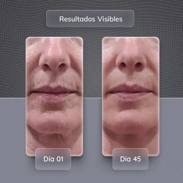 Masajeador Facial de Micro Corriente | Dispositivo de Rejuvenecimiento Facial